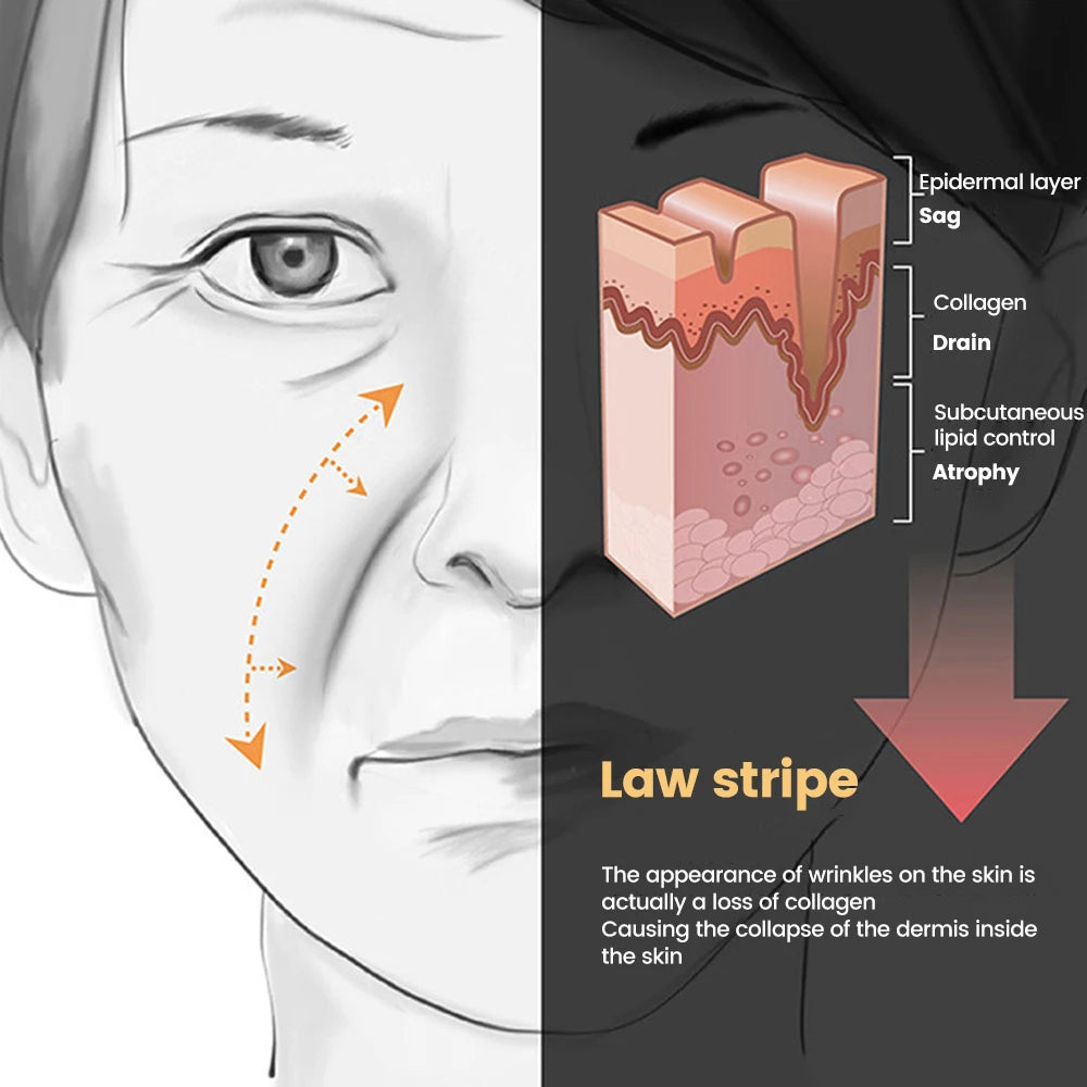 Lifting Mask for Nasolabial Lines