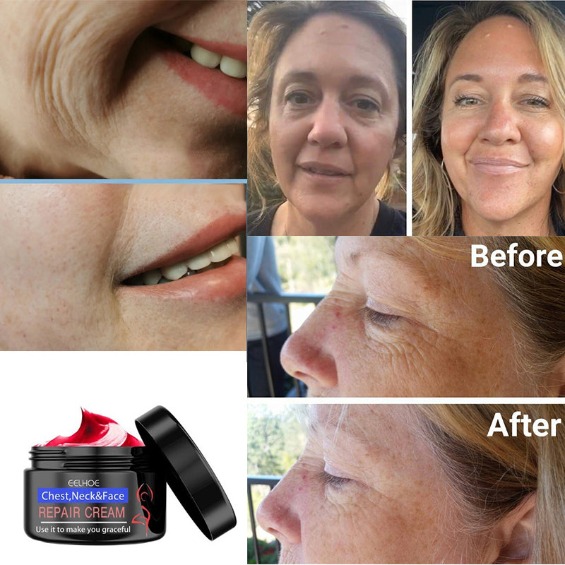 Wrinkle Vanishing Firming Cream for Face, Neck, Chest