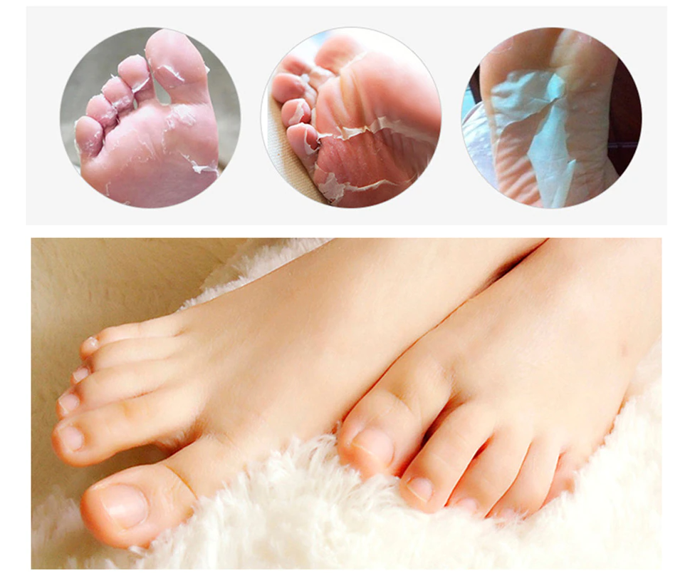 Aloe Vera Foot Peeling Mask