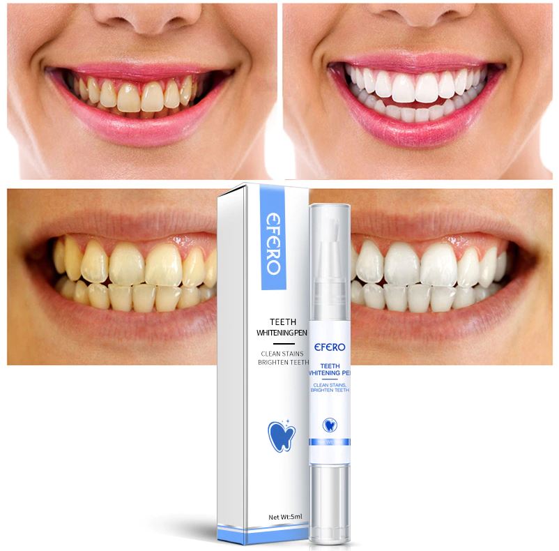 Magic Teeth Whitening Pen