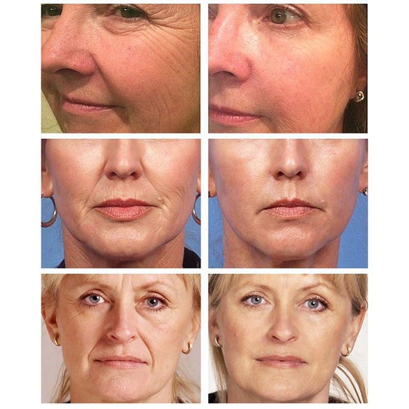 Wrinkle Vanishing Firming Cream for Face, Neck, Chest