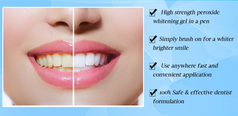 Magic Teeth Whitening Pen
