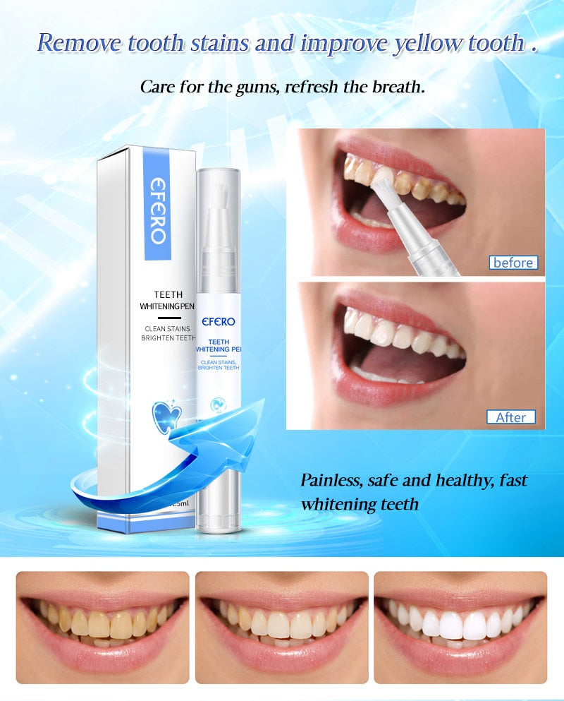 Magic Teeth Whitening Pen