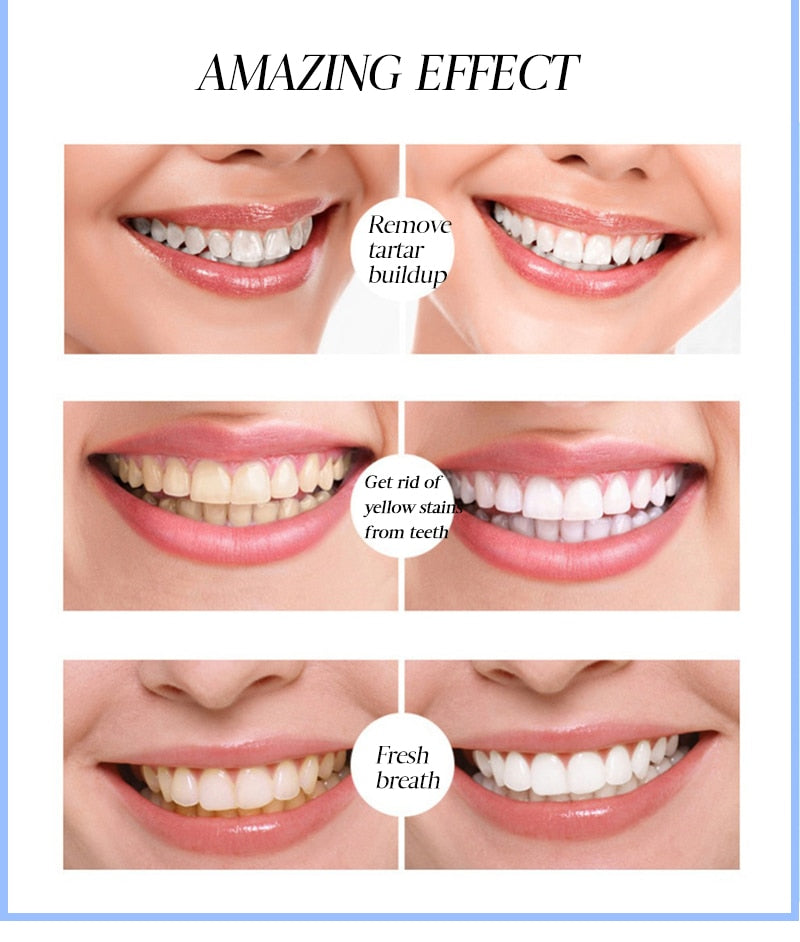 Magic Teeth Whitening Pen