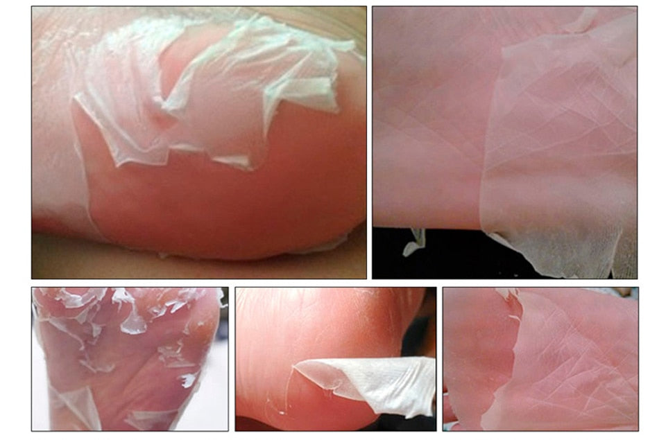 Aloe Vera Foot Peeling Mask